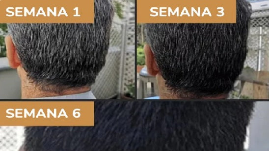 Tratamiento Capilar Natural de Henna Anticanas